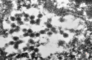 M,8m. | herpes virus, liver M,8m. | herpes virus, liver